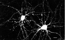 CaMKII alpha/beta, p Thr286, p Thr287 Antibody (22B1), Novus Biologicals